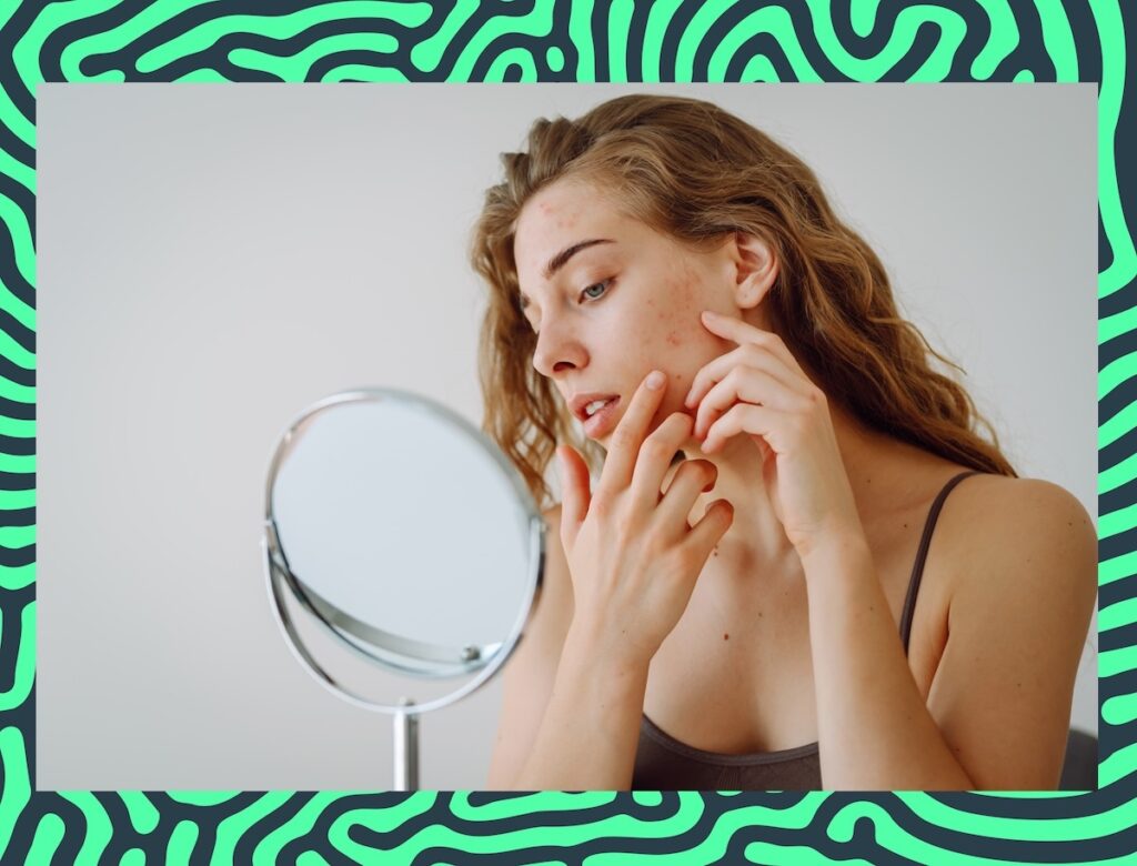 7 Foods That Can Cause Terrible Adult Acne